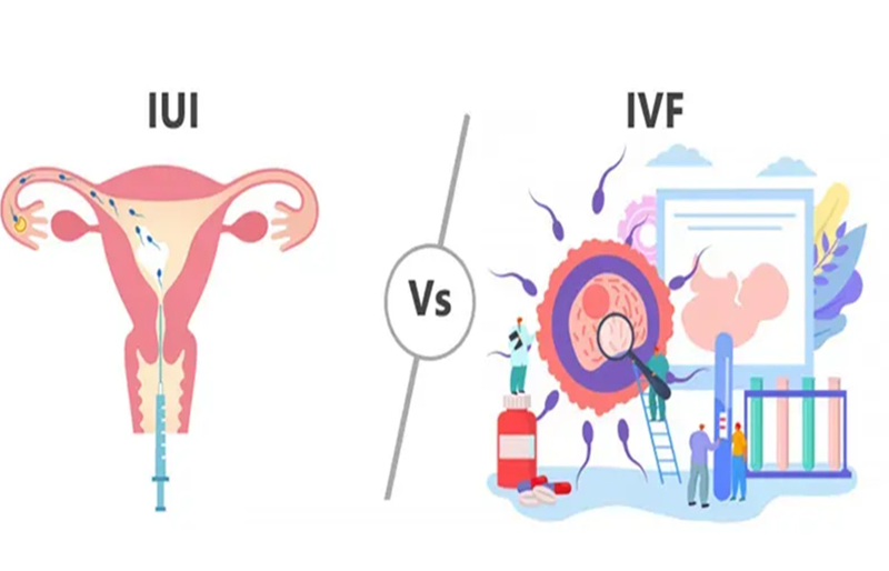 Phân biệt IUI với các kỹ thuật hỗ trợ sinh sản khác