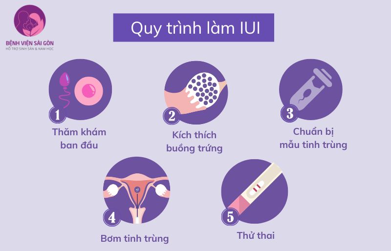 Quy trình làm thụ tinh nhân tạo cho người vô sinh