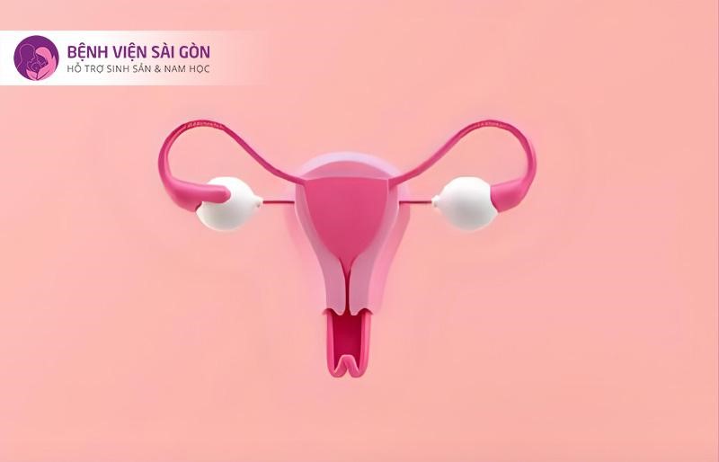 Phương pháp thụ tinh nhân tạo IUI