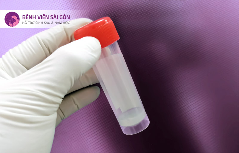 Bất thường trong xuất tinh hoặc chất lượng tinh dịch