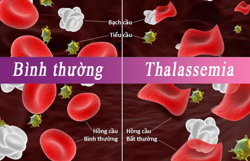 Ý nghĩa của sàng lọc phôi trong điều trị IVF