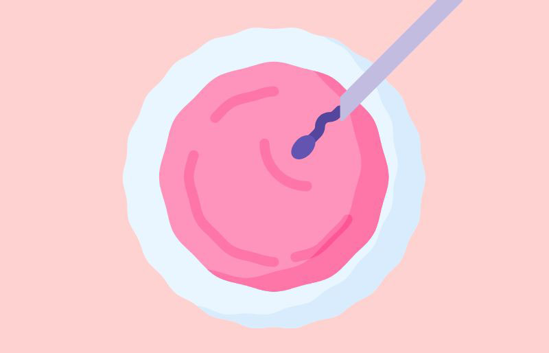 Gom trứng làm IVF gom trứng làm ivf là gì