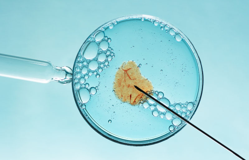 Xét nghiệm NK trong IVF là gì Xét nghiệm NK trong IVF là gì