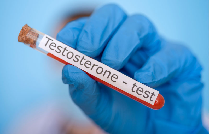 Khám vô sinh nam bao gồm xét nghiệm Testosterone