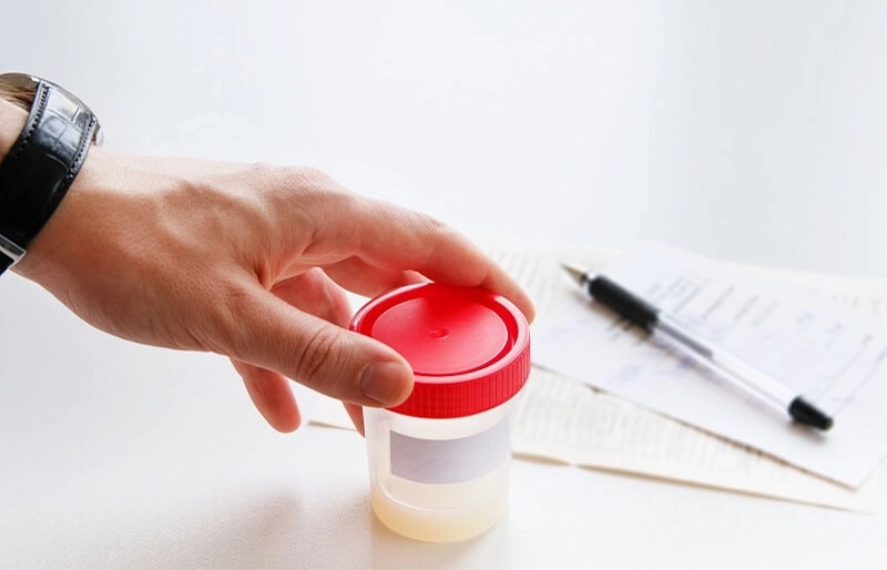 Khám vô sinh ở nam giới