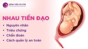 Nhau tiền đạo: Nguyên nhân, triệu chứng, chẩn đoán và cách quản lý an toàn