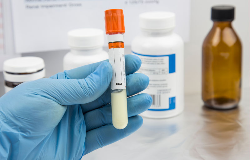 Điều kiện liên quan đến tinh trùng hiến tặng