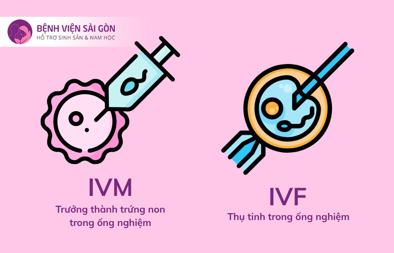 Nên làm IVM hay IVF?