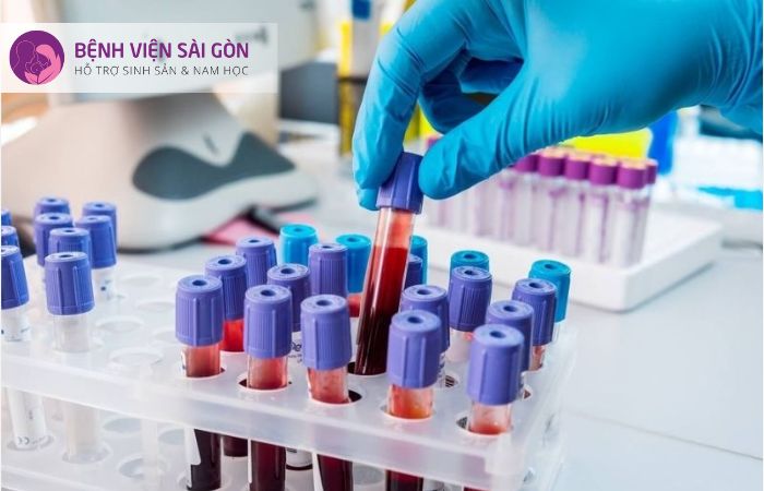 Xét nghiệm Double Test cho kết quả chính xác hơn xét nghiệm Triple Test