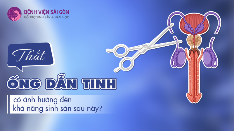 Thắt ống dẫn tinh có ảnh hưởng đến khả năng sinh sản sau này