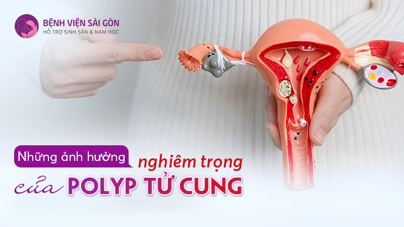 5 biện pháp phòng ngừa viêm bàng quang tái phát cực hữu hiệu