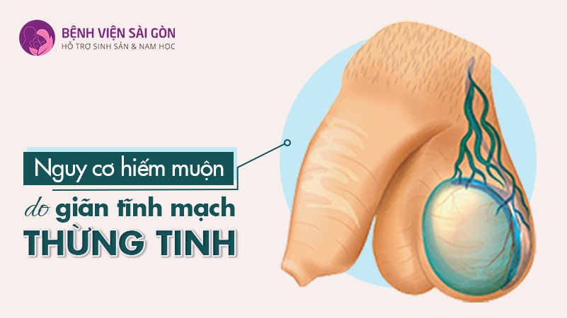 Xét Nghiệm Di Truyền Tiền Làm Tổ & Những Điều Cần Biết