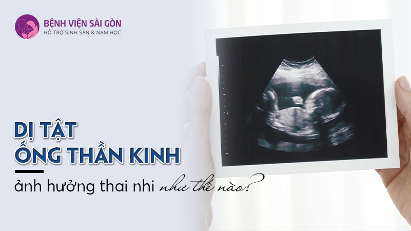 IVF mini có những điểm nổi bật nào?