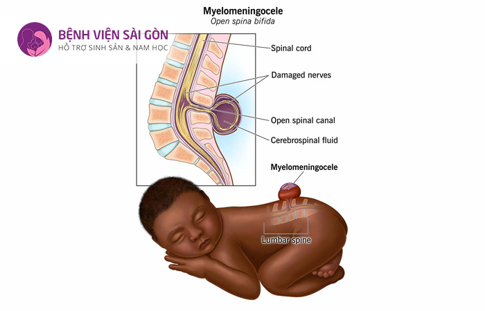 Rối loạn phóng noãn vô cùng nguy hiểm đối với chức năng sinh sản của mẹ