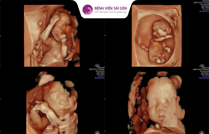 Sau chuyển phôi IVF mini người mẹ cần chú ý đến dinh dưỡng hàng ngày