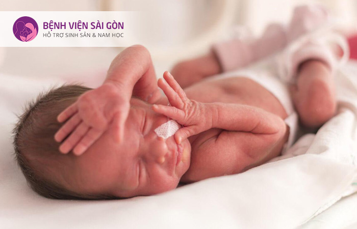 Nhức đầu là một trong những dấu hiệu thai kỳ nguy hiểm mà mẹ bầu cần lưu ý