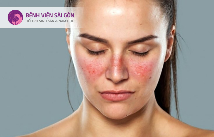 IVF mini đa số người mẹ đều chuyển phôi tươi