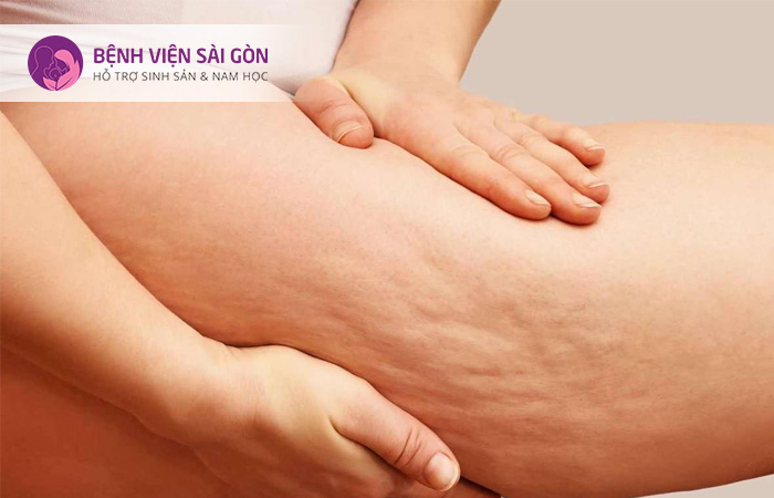 Stress cũng là nguyên nhân gây ra chảy máu bất thường ở âm đạo