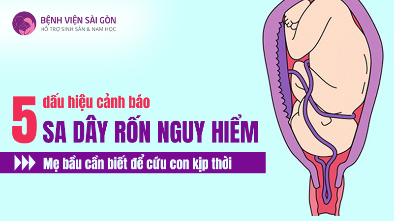 5 Dấu hiệu cảnh báo sa dây rốn nguy hiểm mẹ bầu cần biết để cứu con kịp thời