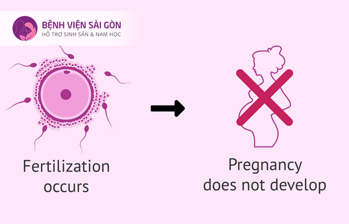 Bệnh lây qua đường tình dục là nguyên nhân gây vô sinh