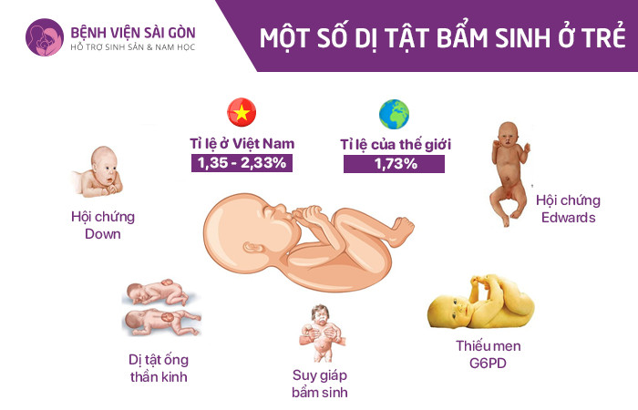 Một số dị tật bẩm sinh ở trẻ