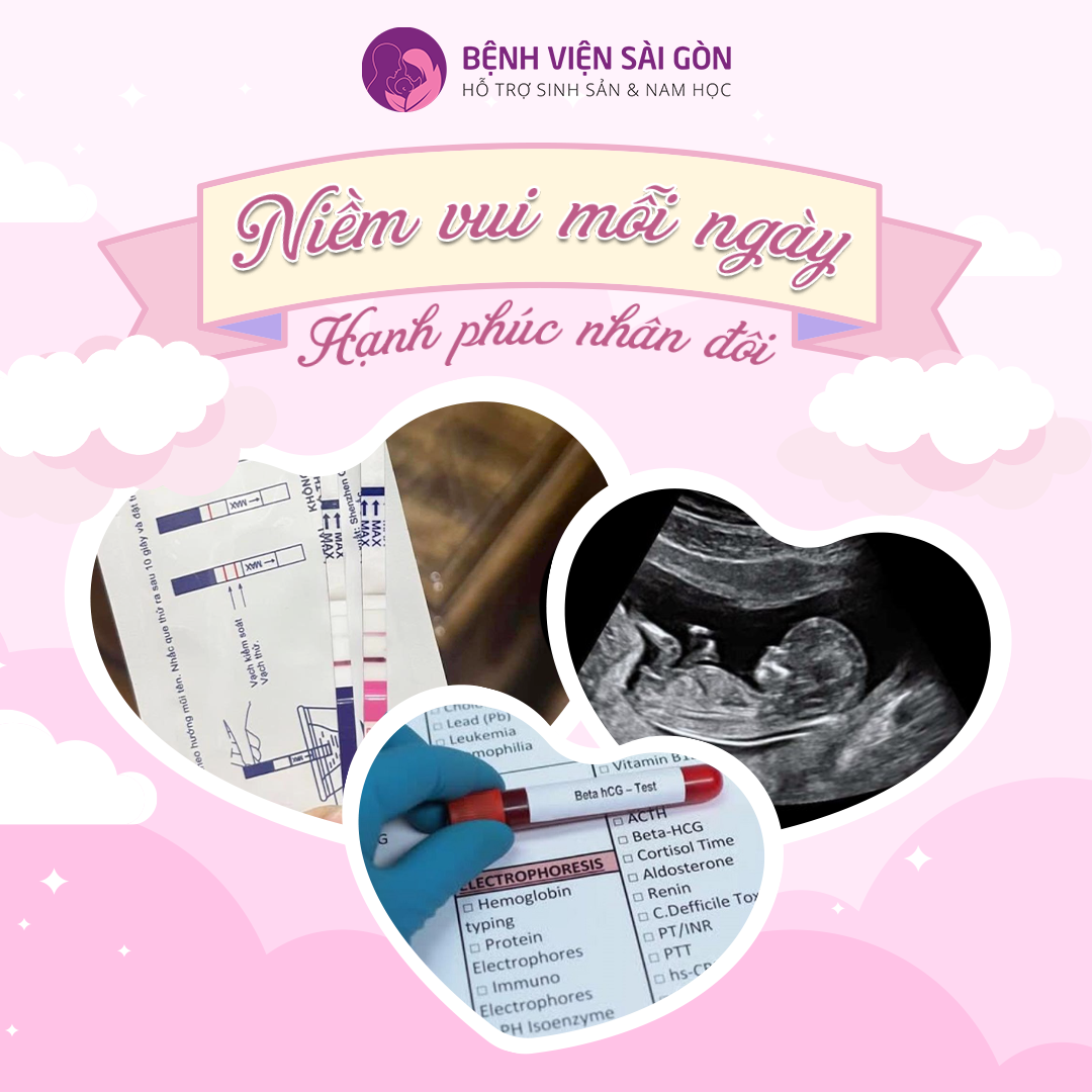 Thắt ống dẫn tinh có thể nối lại nhưng hiệu quả mang thai lại giảm