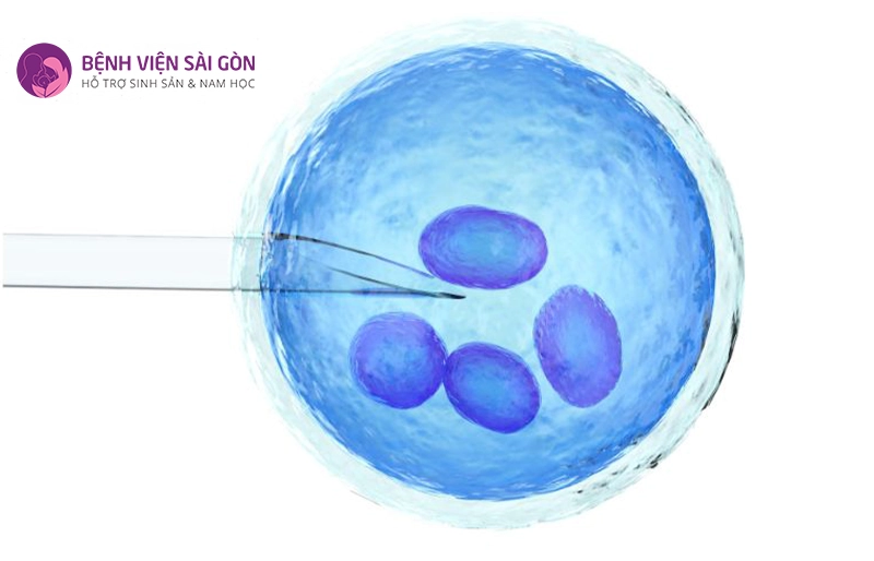 Tìm hiểu gom trứng làm IVF