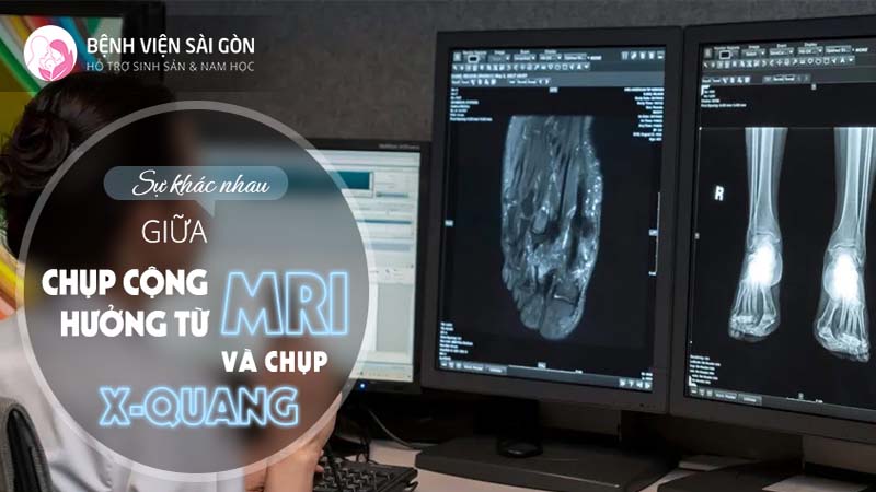 Sự khác nhau giữa chụp cộng hưởng từ MRI và chụp X-quang - Bệnh viện ...