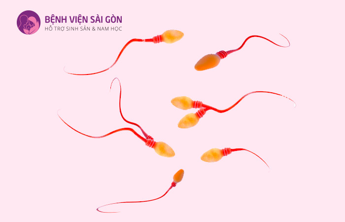 Cải thiện tinh trùng dị dạng như thế nào?