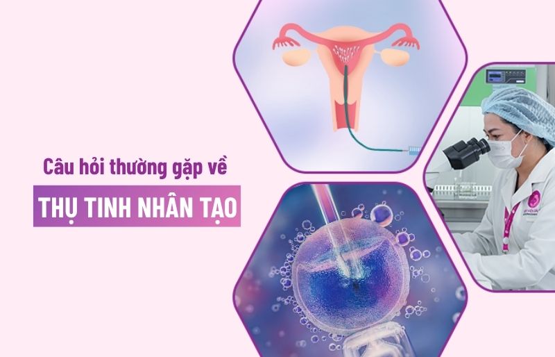 Câu hỏi thường gặp về thụ tinh nhân tạo
