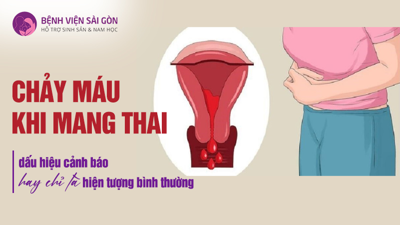 Chảy máu khi mang thai: dấu hiệu cảnh báo hay chỉ là hiện tượng bình thường?