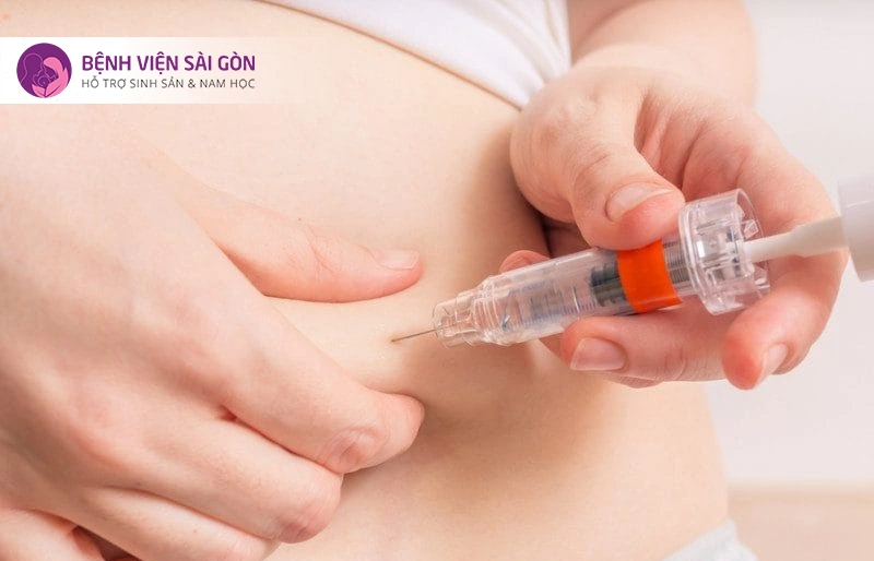 Chi phí chọc hút trứng