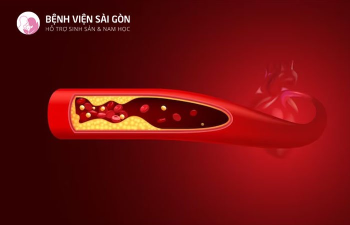 Người mắc một số bệnh liên quan đến tim mạch có thể khiến nữ giới bị kinh nguyệt không đều