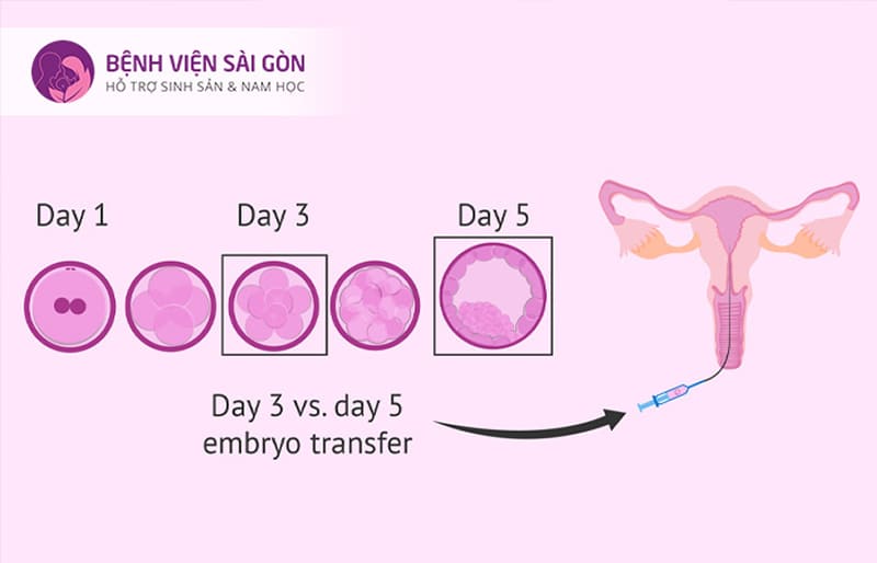 Giải đoạn chuyển phôi