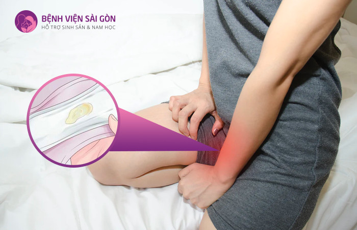 Dịch âm đạo ra nhiều 