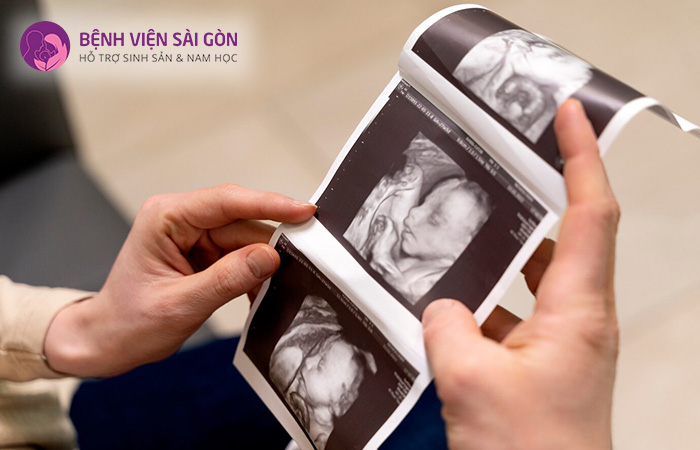 Khám thai định kỳ là một trong những cách phòng ngừa tình trạng sa dây rốn