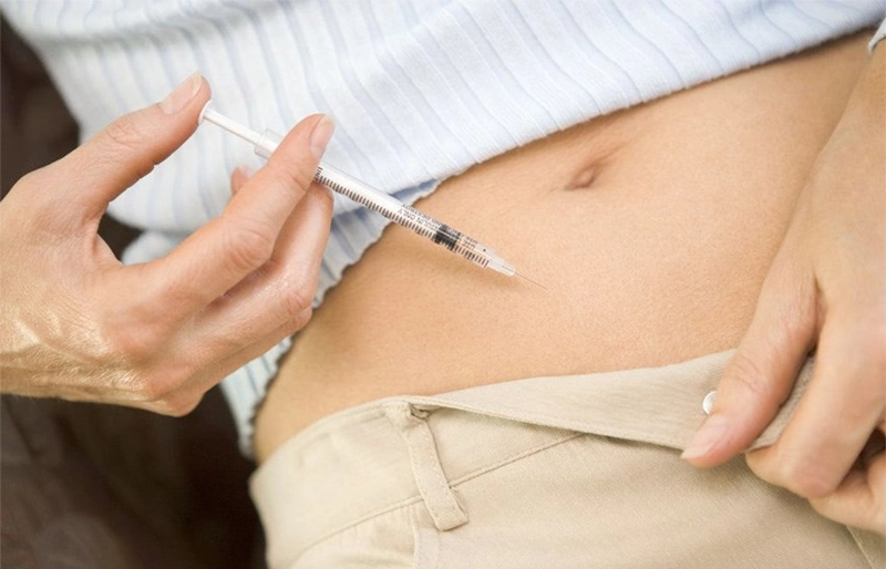 Kích thích buồng trứng