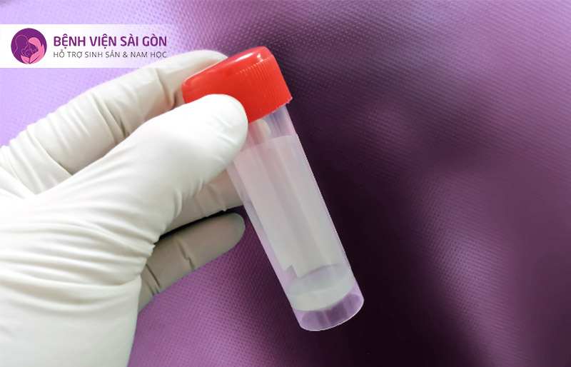 Phân tích tinh dịch đồ