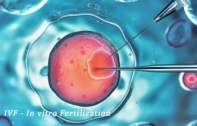 IVF là quá trình thụ tinh trong ống nghiệm