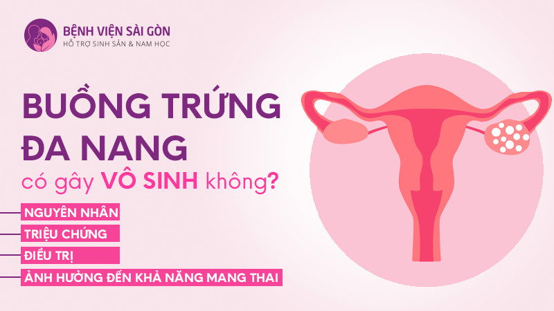 Những điều cần lưu ý về buồng trứng đa nang