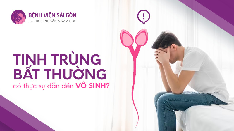 Tinh trùng bất thường có thực sự dẫn đến vô sinh
