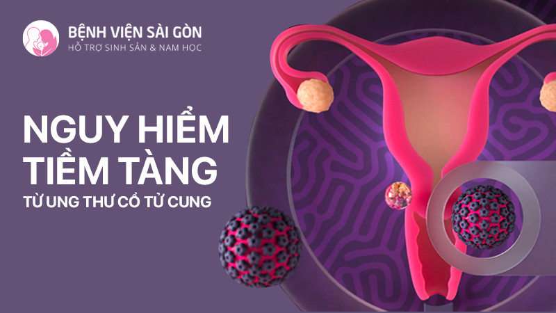 Nguy hiểm tiềm tàng từ ung thư cổ tử cung