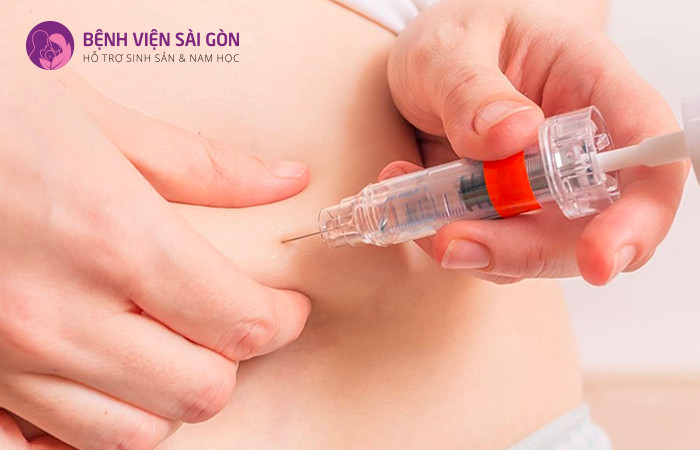 Tiêm kích trứng là một trong những bước quan trọng trong IUI