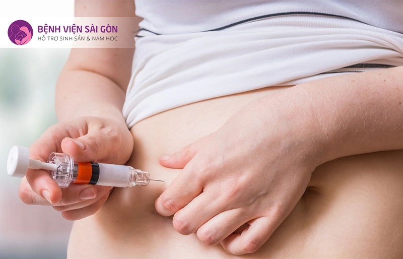 kích thích buồng trứng