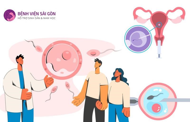 Tìm hiểu thông tin về phương pháp IVF