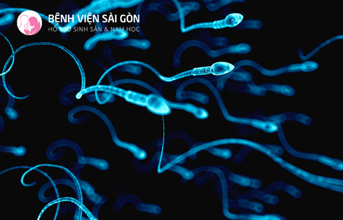 Vô tinh là trường hợp không có tinh trùng trong tinh dịch
