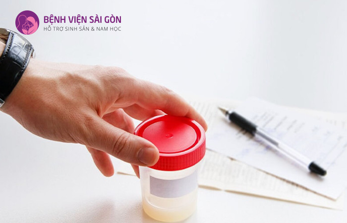 Sau khi lấy mẫu tinh trùng sẽ đem đi lọc rửa để chọn lọc những tinh trùng tốt nhất