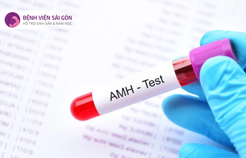 xét nghiệm AMH