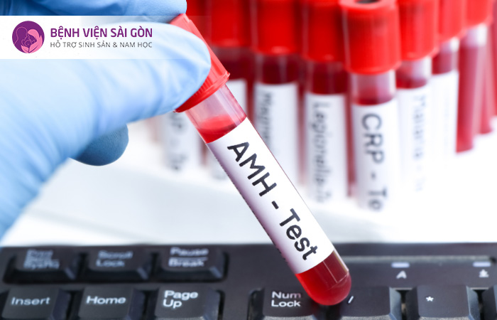 Xét nghiệm AMH