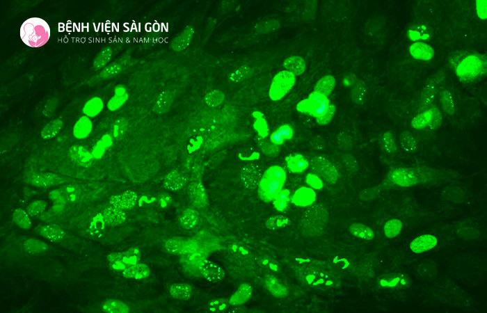 Có thể phát hiện vị khuẩn Chlamydia bằng xét nghiệm huỳnh quang